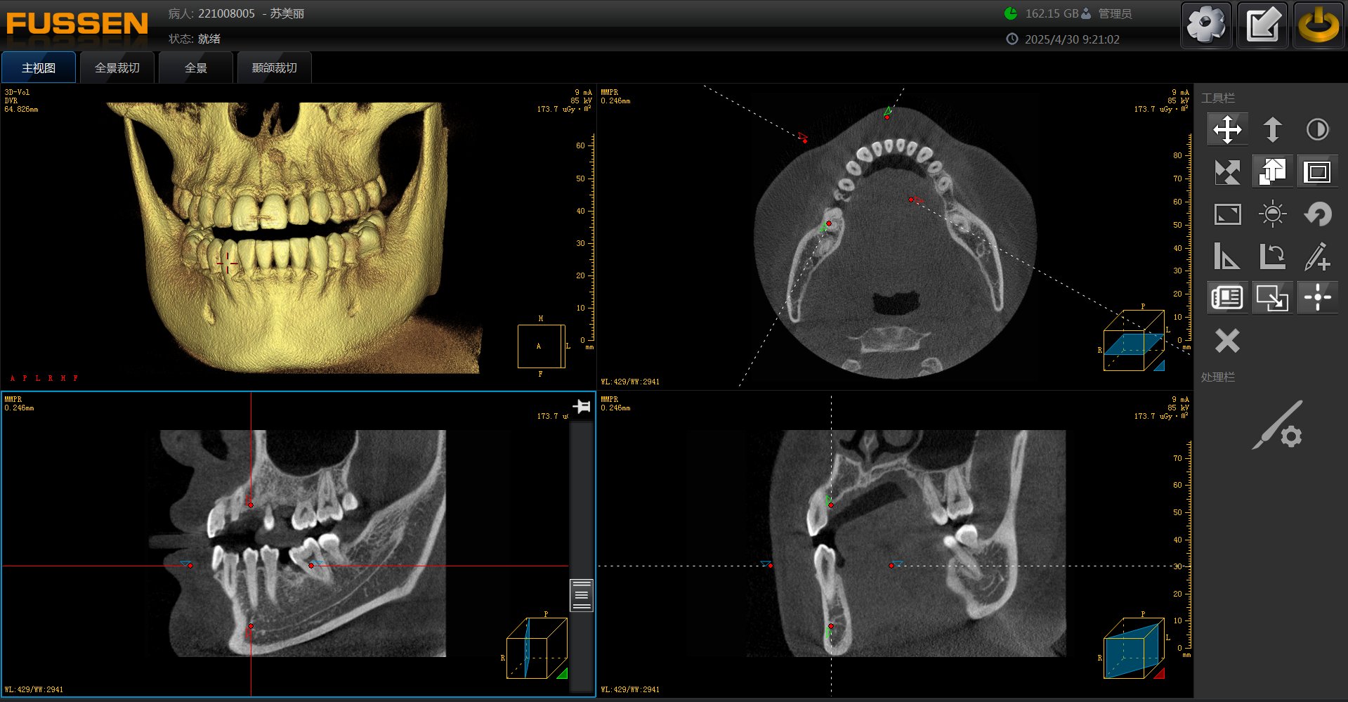 Fussen software — main view