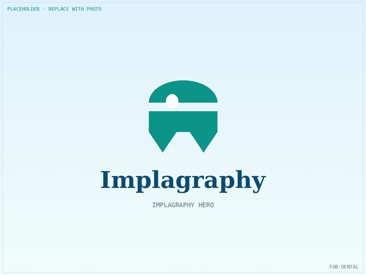Dental Implant Systems for Iraqi Clinicians: Compatible Chinese Alternatives to Straumann, Nobel, and Osstem