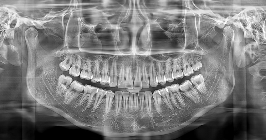 MEYER SS-X9010D Pro-3DE CBCT front angle showing integrated digital touch control panel, patient bite positioner, and motorized pillar