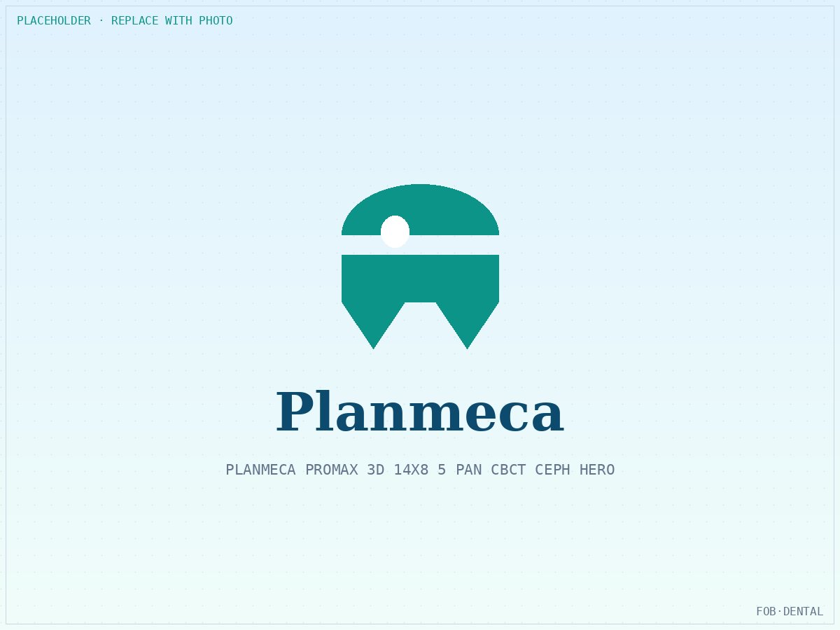 CBCT for Orthodontic Practice: Impacted Canine, Airway, and Surgical Planning