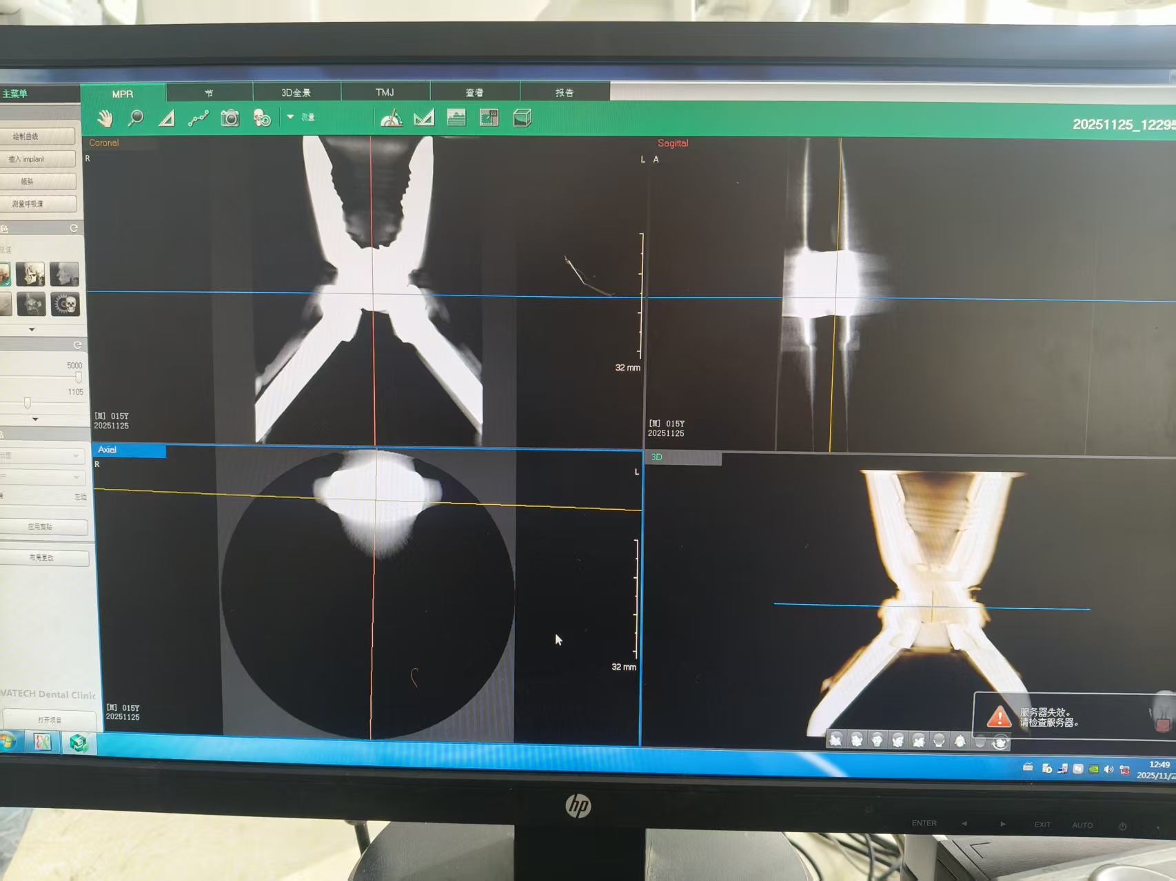 Vatech PAX-i3D EzDent-i Ez3D-i software MPR view showing coronal, sagittal, axial and 3D CBCT reconstruction
